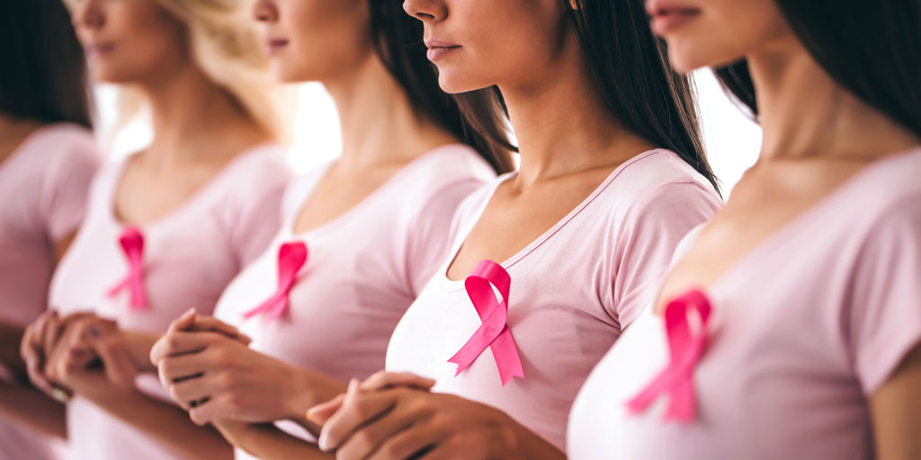breast cancer risk factors